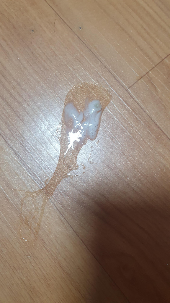 댓글 이미지
